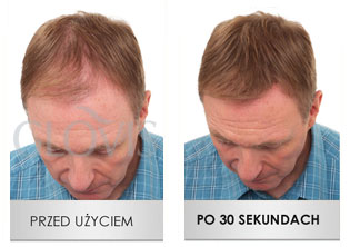 Mikrowłókna do włosów - Przed i po użyciu GLOVIS - przykład 2
