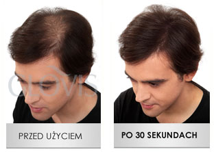 Mikrowłókna do włosów - Przed i po użyciu GLOVIS - przykład 4